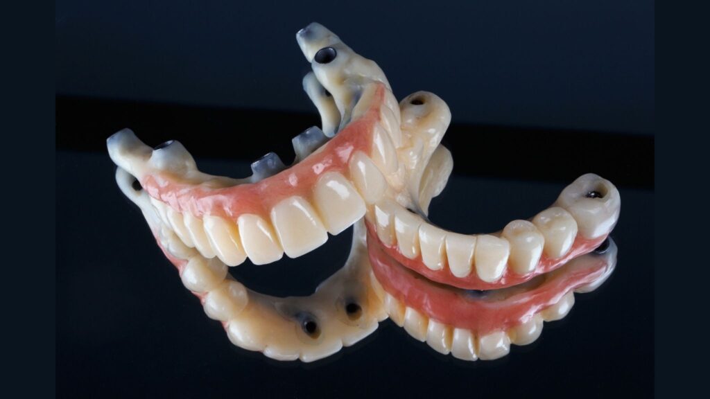 factors-that-affect-all-on-4-dental-implants-cost-in-delray-beach-fl