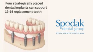 the-materials-that-make-all-on-4-last-decades