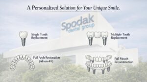 types-of-smile-in-a-day-restorations