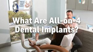 What Are All-on-4 Dental Implants